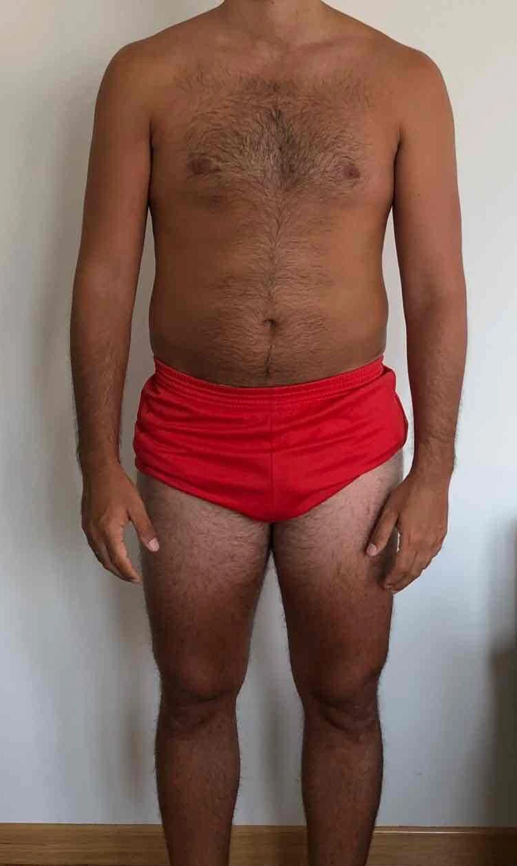 ALBERTO ANTES
