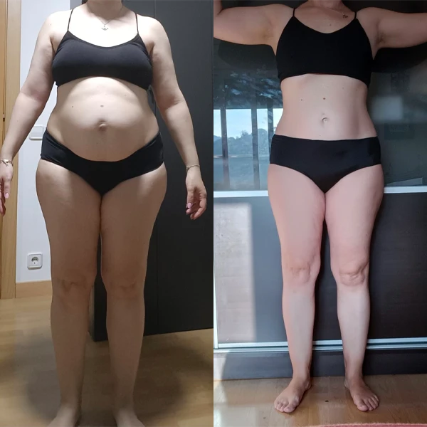 Hace cinco meses, me contactó preocupada por la gran distensión abdominal que tenía desde su embarazo hace dos años y que creía sin solución. Este es el resultado que logró: eliminó definitivamente esa retención y la dejó atrás para siempre.