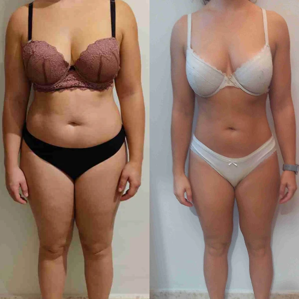 En ocho meses, bajamos 5 kg y logramos una recomposición corporal, consiguiendo un cuerpo tonificado, estético y sin flacidez: más músculo y menos grasa.